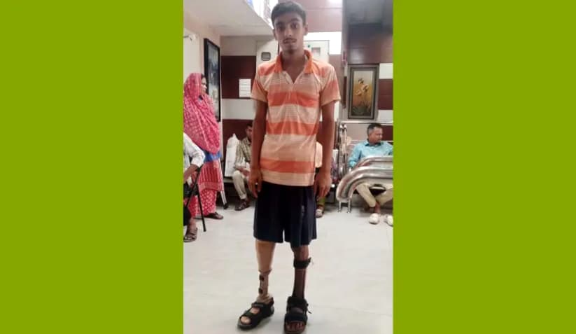 ত্রিশালে পঙ্গুত্ববরণকারী নাজমুলকে কৃত্রিম পা উপহার দিলেন ডাঃ লিটন এমপি